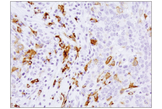 Immunohistochemistry Image 3: CD206/MRC1 (E2L9N) Rabbit mAb