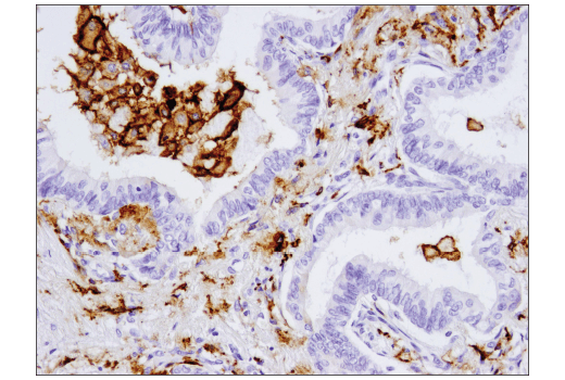 Immunohistochemistry Image 4: CD206/MRC1 (E2L9N) Rabbit mAb