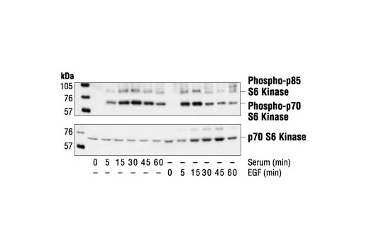 Western Blotting Image 1: Phospho-p70 S6 Kinase (Thr421/Ser424) Antibody