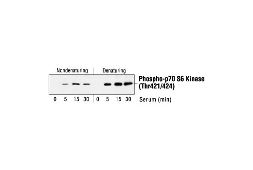 Immunoprecipitation Image 1: Phospho-p70 S6 Kinase (Thr421/Ser424) Antibody