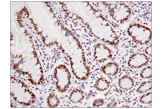 Immunohistochemistry Image 3: WHSC1L1 (D4N9N) Rabbit mAb