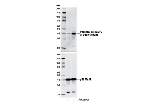  Image 4: PhosphoPlus® p38 MAPK (Thr180/Tyr182) Antibody Kit