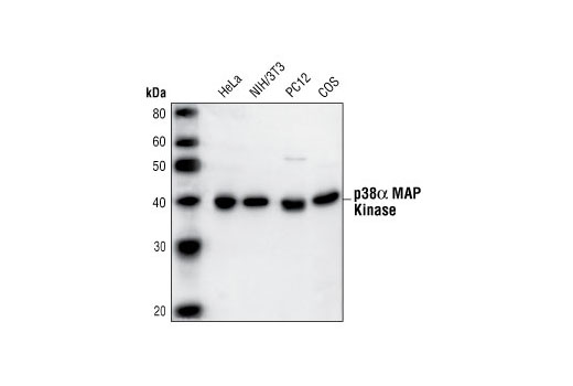 Western Blotting Image 1: p38α MAPK Antibody