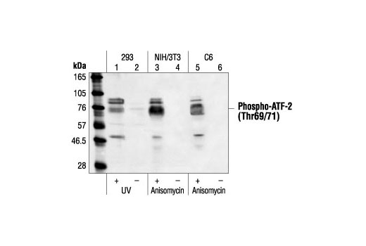 Western Blotting Image 1: Phospho-ATF-2 (Thr69/71) Antibody