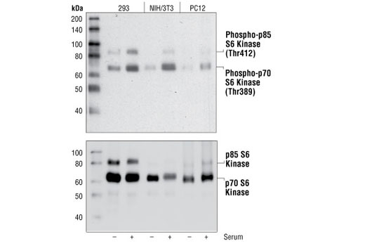  Image 3: PhosphoPlus® p70 S6 Kinase (Thr389) Antibody Duet