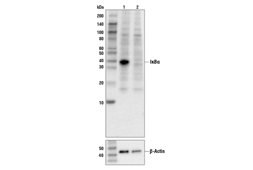 Western Blotting Image 1: IκBα Antibody