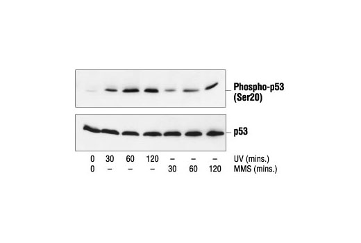 Western Blotting Image 1: Phospho-p53 (Ser20) Antibody