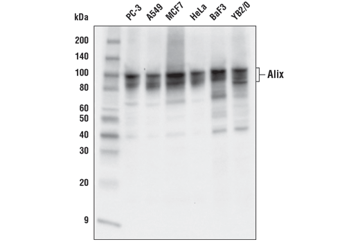  Image 21: Human Reactive Exosome Marker Antibody Sampler Kit