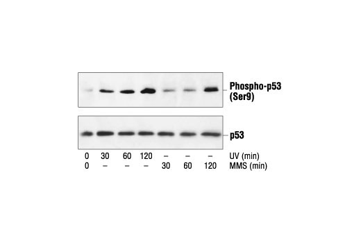 Western Blotting Image 1: Phospho-p53 (Ser9) Antibody