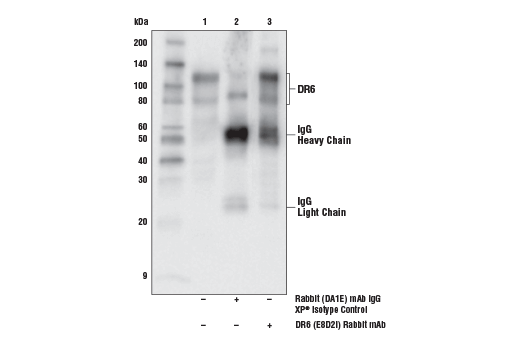 Immunoprecipitation Image 1: DR6 (E8D2I) Rabbit mAb
