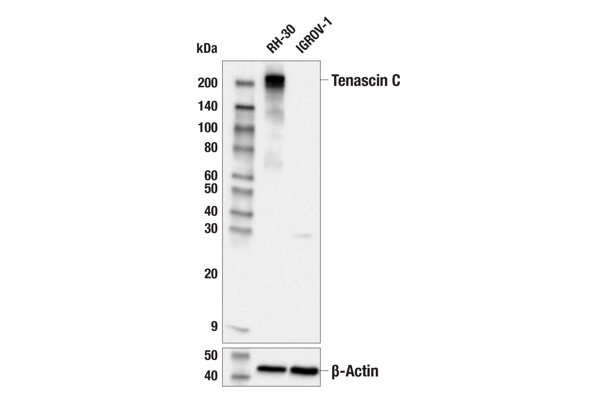 Western Blotting Image 1: Tenascin C (E6N4L) Rabbit mAb