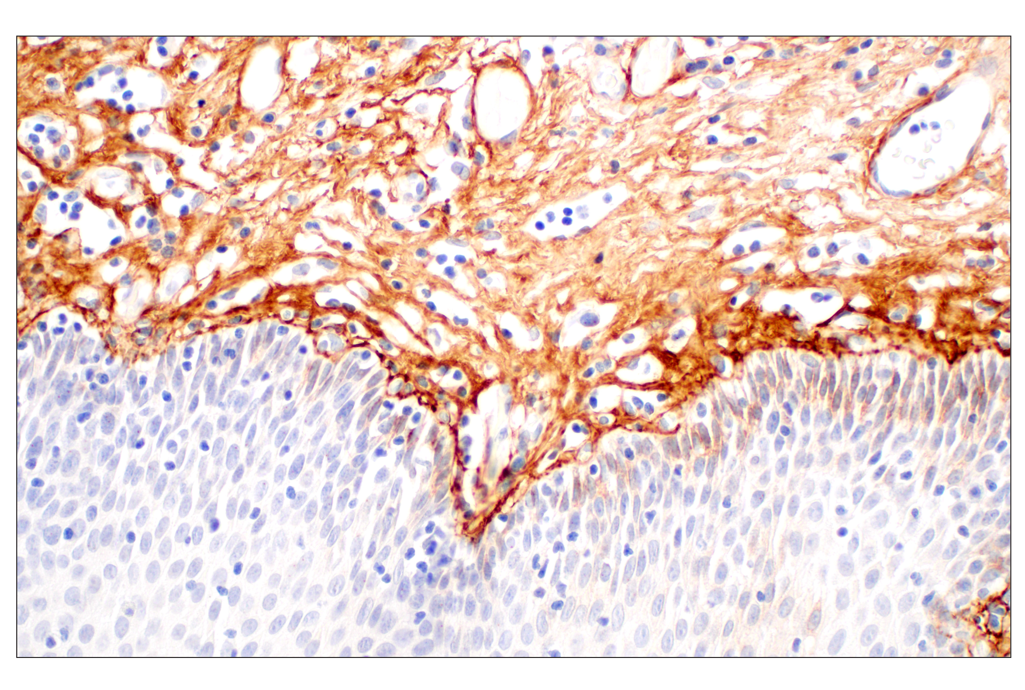 Immunohistochemistry Image 8: Tenascin C (E6N4L) Rabbit mAb