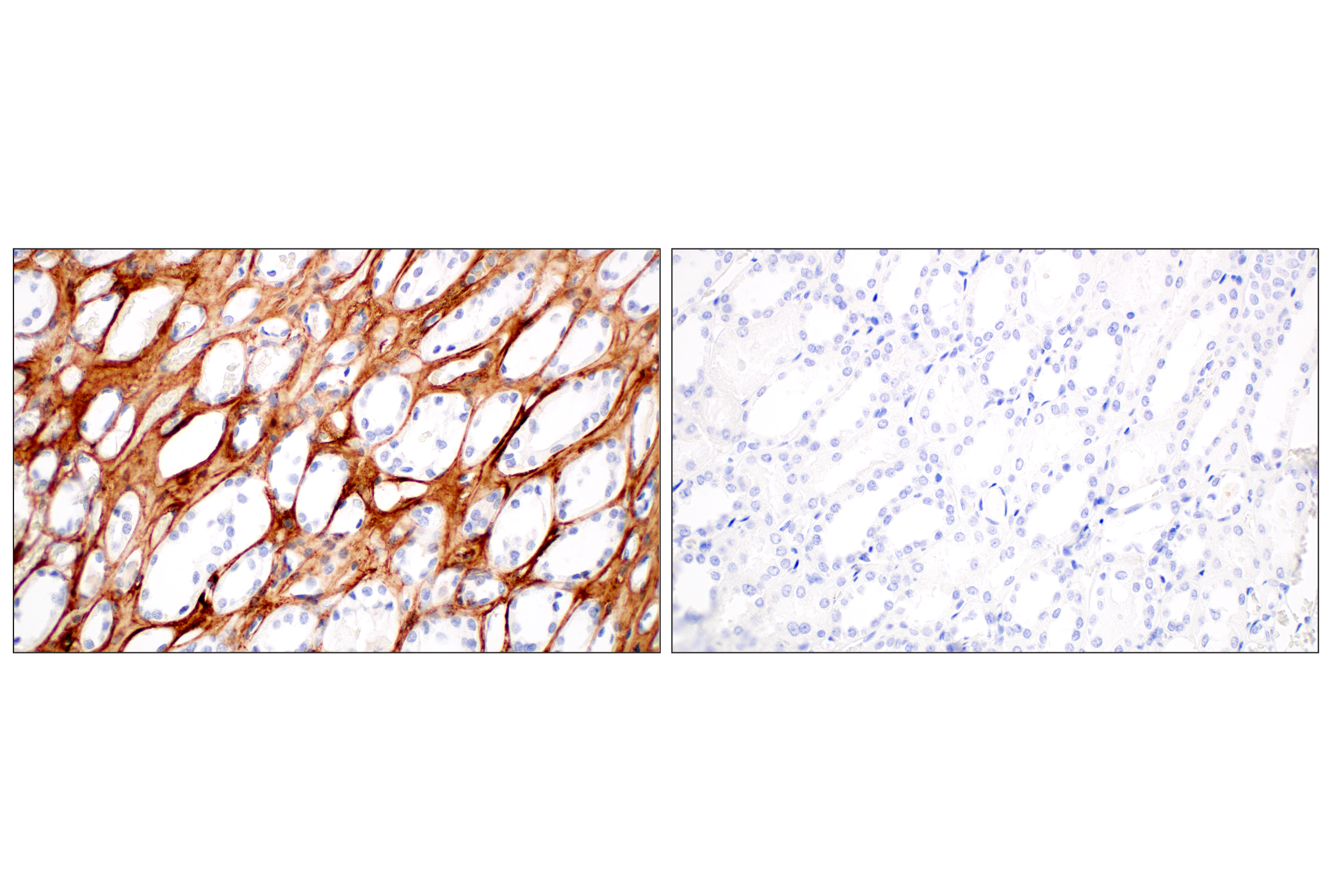 Immunohistochemistry Image 9: Tenascin C (E6N4L) Rabbit mAb