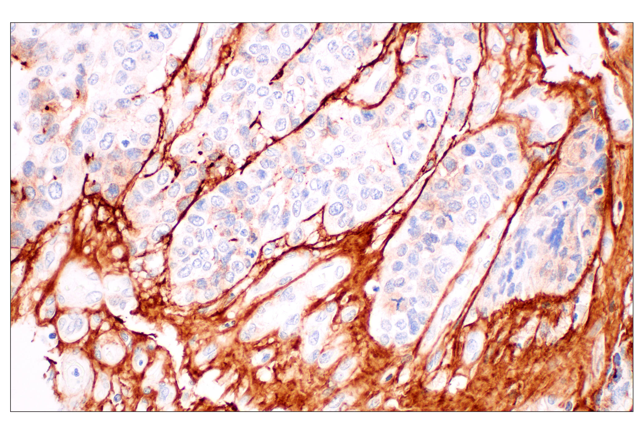 Immunohistochemistry Image 6: Tenascin C (E6N4L) Rabbit mAb