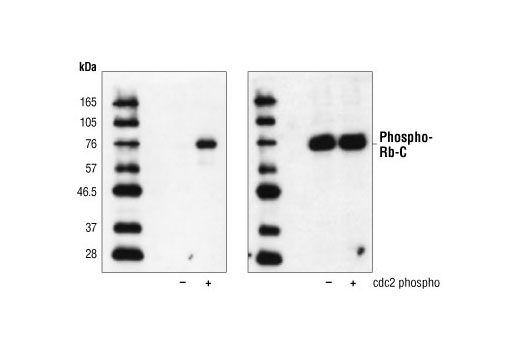 Western Blotting Image 1: Rb Control Proteins