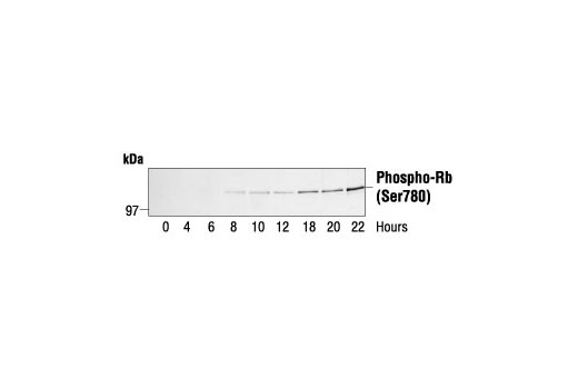 Western Blotting Image 1: Phospho-Rb (Ser780) Antibody