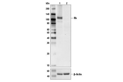  Image 11: PhosphoPlus® Rb (Ser780, Ser807/811) Antibody Kit
