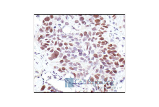 Immunohistochemistry Image 2: Rb (4H1) Mouse mAb