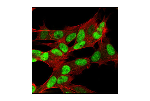 Immunofluorescence Image 1: Rb (4H1) Mouse mAb