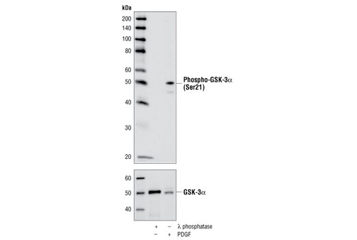  Image 7: GSK-3 Antibody Sampler Kit