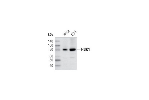 Western Blotting Image 2: RSK1 Antibody