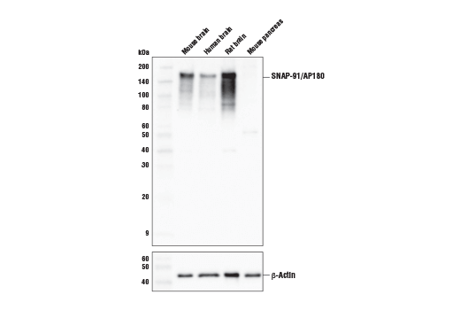 Western Blotting Image 1: SNAP-91/AP180 Antibody