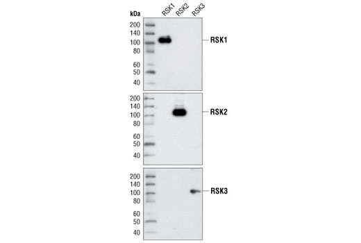 Western Blotting Image 1: RSK2 Antibody