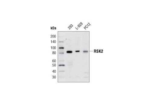 Western Blotting Image 2: RSK2 Antibody