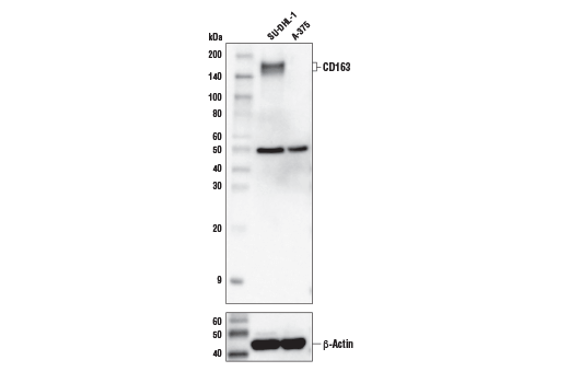  Image 11: Human Reactive M1 vs M2 Macrophage IHC Antibody Sampler Kit