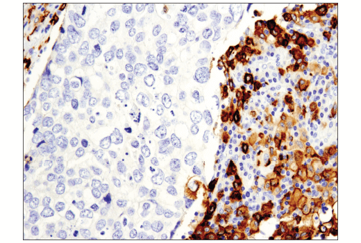 Immunohistochemistry Image 4: CD163 (D6U1J) Rabbit mAb