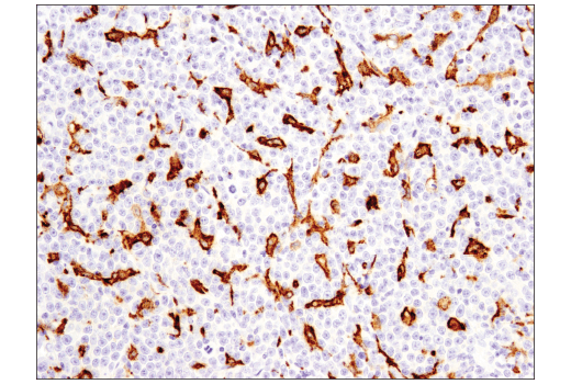  Image 45: Human Reactive M1 vs M2 Macrophage IHC Antibody Sampler Kit