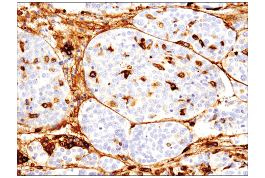Immunohistochemistry Image 6: CD163 (D6U1J) Rabbit mAb