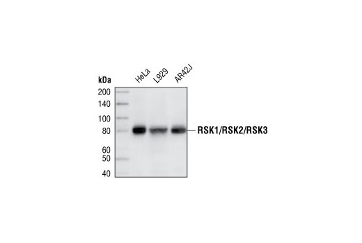  Image 4: p90RSK Antibody Sampler Kit