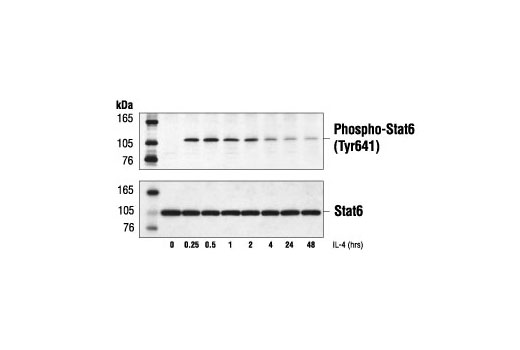 Western Blotting Image 1: Phospho-Stat6 (Tyr641) Antibody