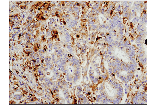 Immunohistochemistry Image 1: Legumain (D6S4H) Rabbit mAb