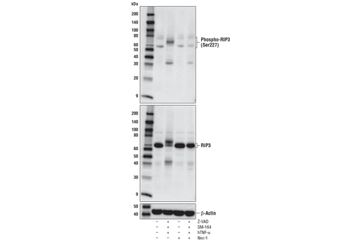  Image 23: Apoptosis/Necroptosis Antibody Sampler Kit II