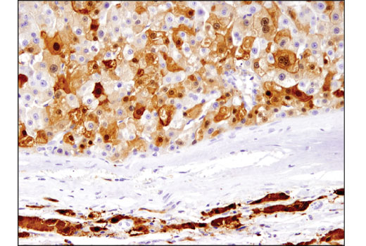  Image 33: Mouse Reactive M1 vs M2 Macrophage IHC Antibody Sampler Kit