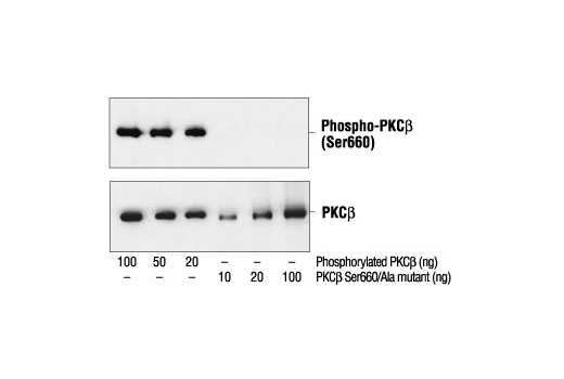  Image 6: Phospho-PKC Antibody Sampler Kit