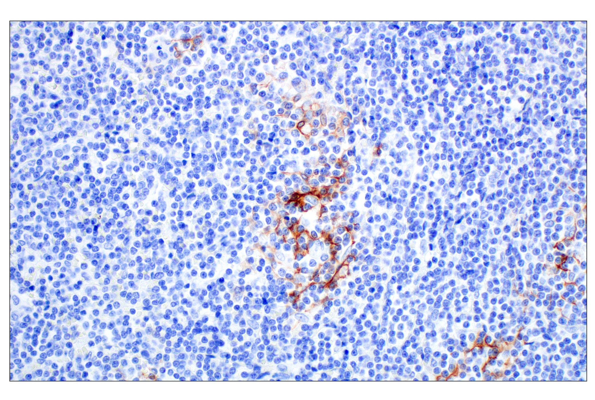 Immunohistochemistry Image 1: MAdCAM-1 (E1V8F) Rabbit mAb