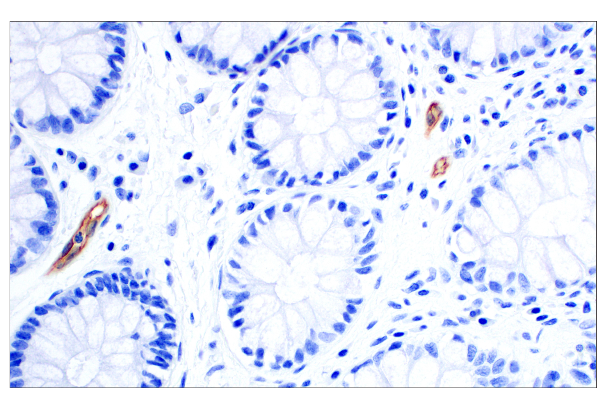Immunohistochemistry Image 3: MAdCAM-1 (E1V8F) Rabbit mAb
