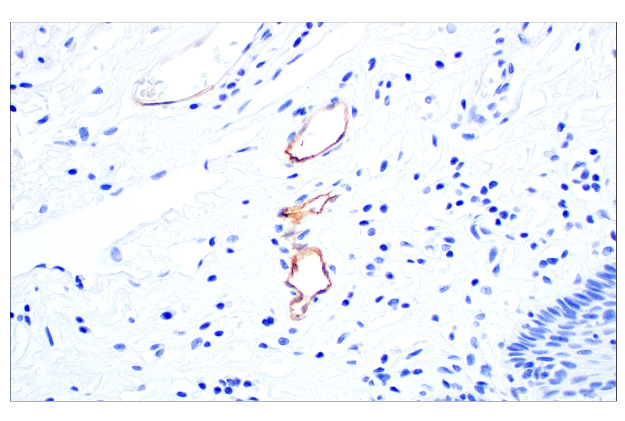 Immunohistochemistry Image 4: MAdCAM-1 (E1V8F) Rabbit mAb