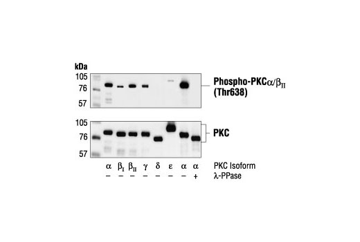 Western Blotting Image 1: Phospho-PKCα/β II (Thr638/641) Antibody