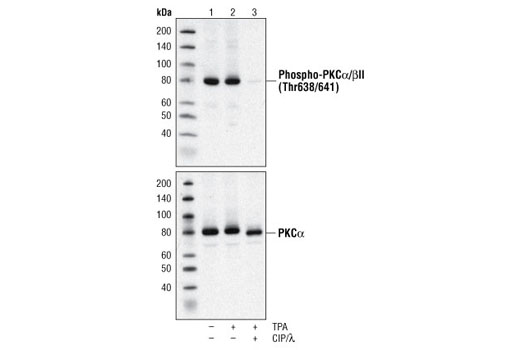 Western Blotting Image 2: Phospho-PKCα/β II (Thr638/641) Antibody