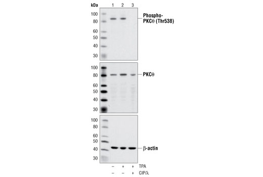 Western Blotting Image 1: Phospho-PKCθ (Thr538) Antibody