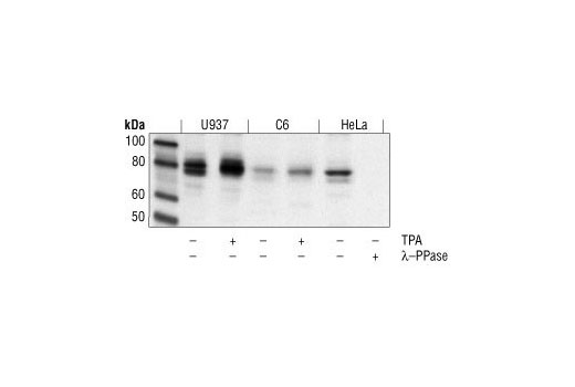 Western Blotting Image 1: Phospho-PKC (pan) (gamma Thr514) Antibody
