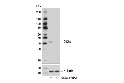  Image 1: SignalSilence® CK2α siRNA I (Rodent Specific)