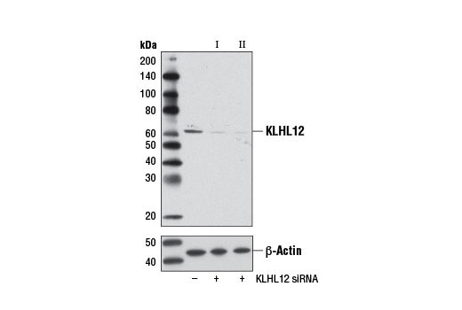  Image 1: SignalSilence® KLHL12 siRNA I