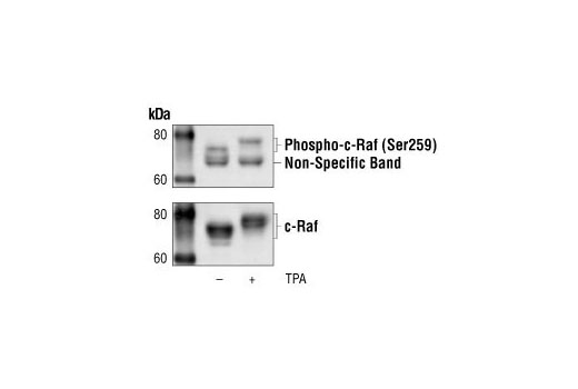 Western Blotting Image 1: Phospho-c-Raf (Ser259) Antibody