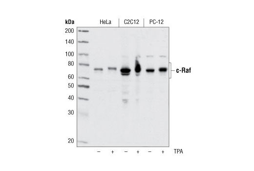 Western Blotting Image 1: c-Raf Antibody
