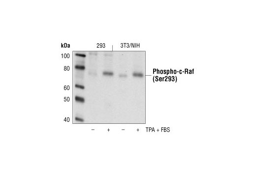 Western Blotting Image 1: Phospho-c-Raf (Ser296) Antibody
